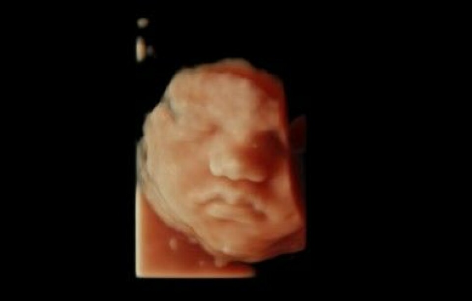 3D-bilde av foster i tredje trimester. Foto: OUS.