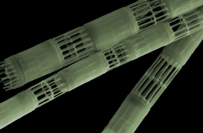 Planteplanktonet Skeletonema costatum. (Foto: Stig Bjarte Haugen, Havforskningsinstituttet) Planteplanktonet Skeletonema costatum. (Foto: Stig Bjarte Haugen, Havforskningsinstituttet)