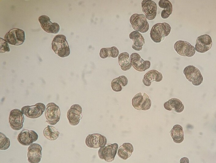 Analyser av pollenprøver, her furupollen sett i mikroskop, kan lære oss mye om fortidens vegetasjon og klima. (Foto: Mari Jokerud) Analyser av pollenprøver, her furupollen sett i mikroskop, kan lære oss mye om fortidens vegetasjon og klima. (Foto: Mari Jokerud)