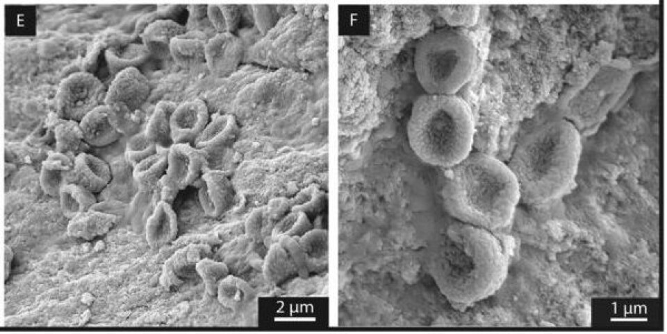 Røde blodceller i 183 millioner år gammelt fiskeøglefossil? Kanskje. Foto (SEM): Plet et al.