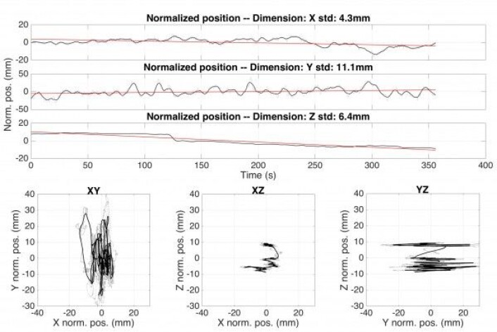 Grafer som viser bevegelsene til en person som står stille i 6 minutter. De tre øverste grafene viser bevegelsene sideveis (X), frem-tilbake (Y) og opp-ned (Z). Legg merke til hvordan personen "synker" litt sammen over tid. De tre nederste grafene viser hvordan de tre aksene varierer i forhold til herandre. XY-grafen viser et fugleperspektiv, med forsøkspersonens nese pekende oppover. Her kan man tydelig se at mesteparten av bevegelsen kommer fra svaiing frem og tilbake. Grafer som viser bevegelsene til en person som står stille i 6 minutter. De tre øverste grafene viser bevegelsene sideveis (X), frem-tilbake (Y) og opp-ned (Z). Legg merke til hvordan personen "synker" litt sammen over tid. De tre nederste grafene viser hvordan de tre aksene varierer i forhold til herandre. XY-grafen viser et fugleperspektiv, med forsøkspersonens nese pekende oppover. Her kan man tydelig se at mesteparten av bevegelsen kommer fra svaiing frem og tilbake.