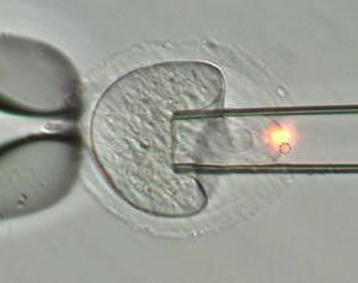 Reduksjon av muse-eggets størrelse ved mikromanipulering: Egget holdes fast av en holdepipette (fra venstre side), mens litt av cellens innhold suges ut med en 19 µm bred pipette (fra høyre side). Det røde lyset kommer fra laseren som brukes for å lage hull i skallet, zona pellucida. Foto: Gareth Greggains, Reproduksjonsmedisinsk avdeling ved Oslo Universitetssykehus. Reduksjon av muse-eggets størrelse ved mikromanipulering: Egget holdes fast av en holdepipette (fra venstre side), mens litt av cellens innhold suges ut med en 19 µm bred pipette (fra høyre side). Det røde lyset kommer fra laseren som brukes for å lage hull i skallet, zona pellucida. Foto: Gareth Greggains, Reproduksjonsmedisinsk avdeling ved Oslo Universitetssykehus.