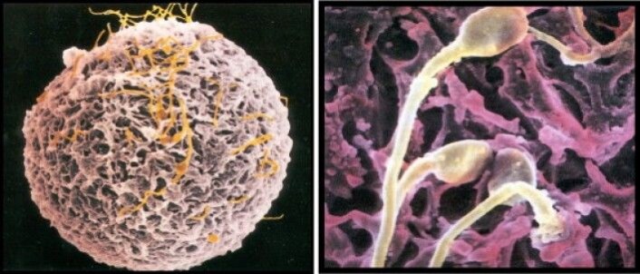 Befruktning: Spermier (gulaktige) som prøver å trenge gjennom skallstrukturen, zona pellucida, som omgir egget (rosa). (Foto: SATHANANTHAN, A. H. 1996. Visual Atlas of Human Sperm Structure and Function for Assisted Reproductive Technology, National University of Singapore.) Befruktning: Spermier (gulaktige) som prøver å trenge gjennom skallstrukturen, zona pellucida, som omgir egget (rosa). (Foto: SATHANANTHAN, A. H. 1996. Visual Atlas of Human Sperm Structure and Function for Assisted Reproductive Technology, National University of Singapore.)