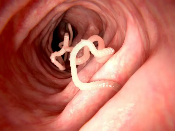 Fordelen ved å være helt unik er at parasitter får noe å bryne seg på. Her ser du en bendelorm. (Foto: Juan Gaertner, Shutterstock, NTB scanpix)