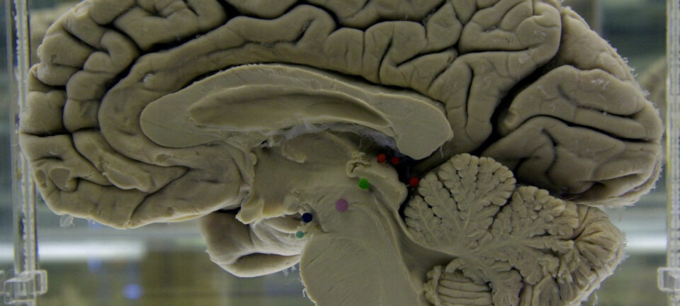 En menneskehjerne på sprit i New York i USA. (Illustrasjonsbilde: AP Photo/David Duprey/NTB Scanpix)