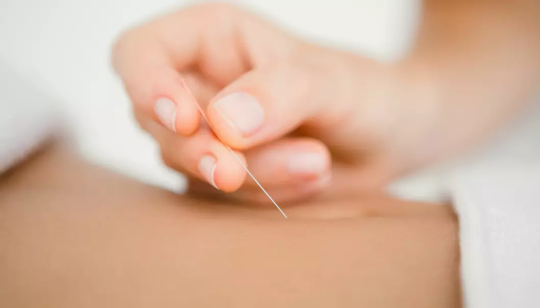 Akupunktur økte ikke sjansen for å bli gravid