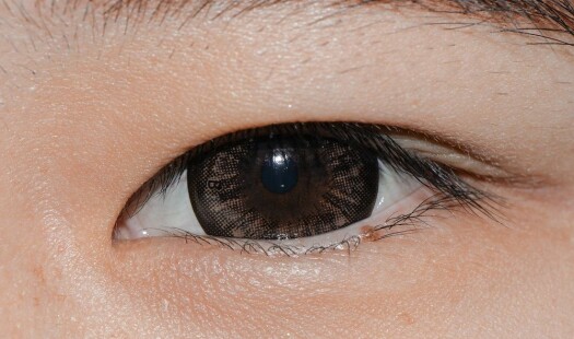 Blir du blind hvis linsen i øyet løsner?
