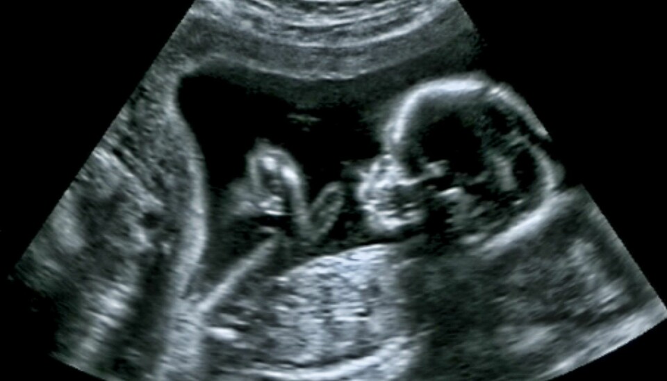 Når skal barnet fødes? De fleste graviditeter i Norge får en termindato basert på ultralyd. Men hvilke metoder fagfolkene bruker for å vurdere ultralydbildene på, er forskjellige.   (Foto: Shutterstock)
