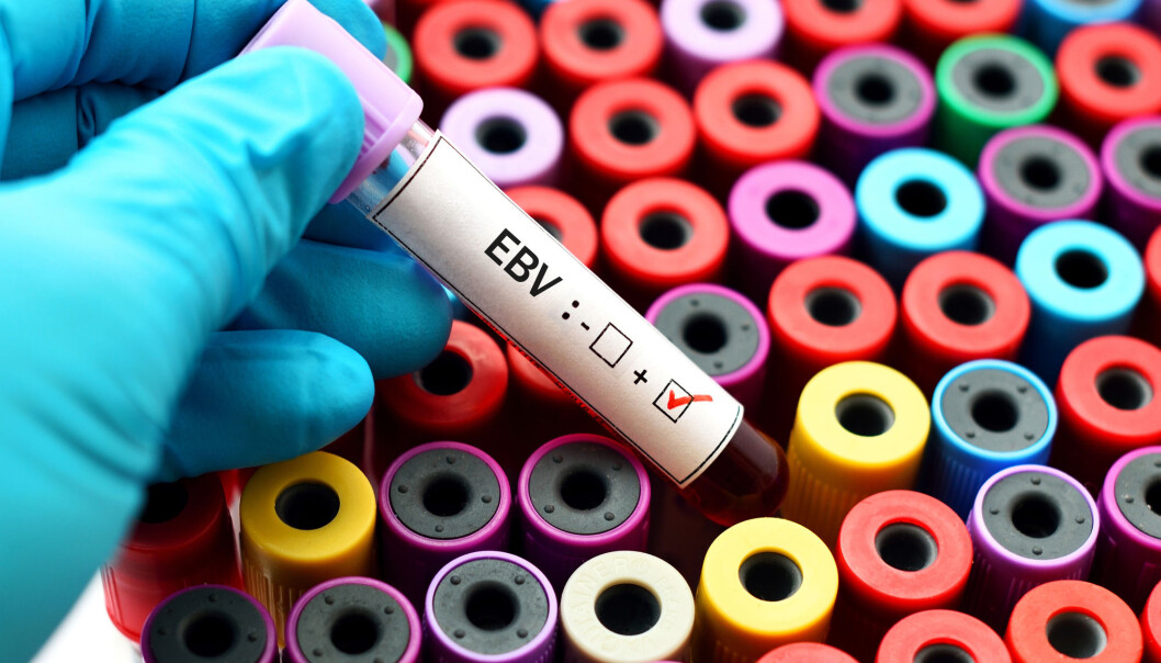 Det finnes ingen vaksine for Epstein-Barr-viruset (EBV). Kanskje vil de nye resultatene inspirere forskere til å jobbe mer intenst med å finne en? (Foto: Jarun Ontakrai / Shutterstock / NTB scanpix) Det finnes ingen vaksine for Epstein-Barr-viruset (EBV). Kanskje vil de nye resultatene inspirere forskere til å jobbe mer intenst med å finne en? (Foto: Jarun Ontakrai / Shutterstock / NTB scanpix)