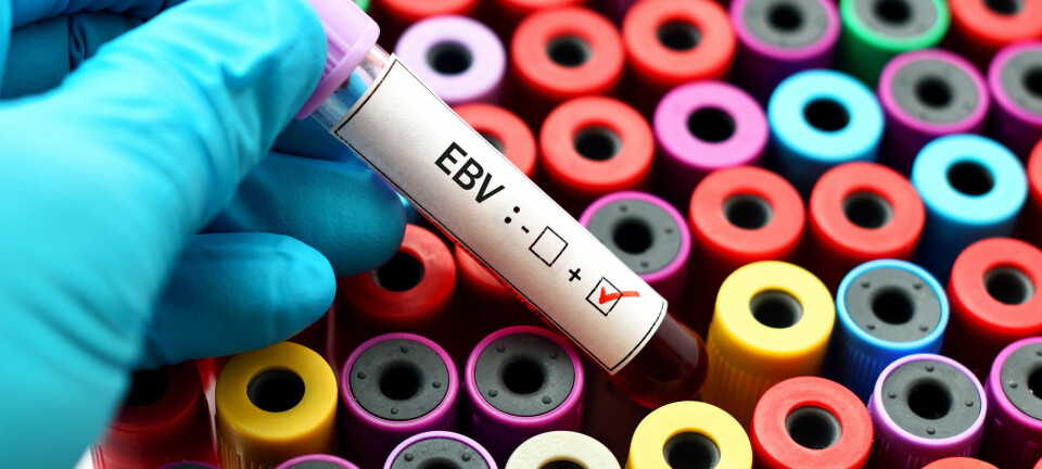 Det finnes ingen vaksine for Epstein-Barr-viruset (EBV). Kanskje vil de nye resultatene inspirere forskere til å jobbe mer intenst med å finne en?  (Foto: Jarun Ontakrai / Shutterstock / NTB scanpix)