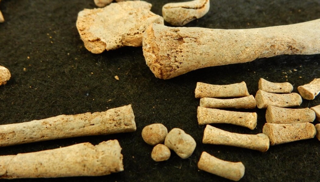 Knokler fra et 6 mnd gammel barn som ble analysert i prosjektet. Disse inneholdt elgammel syfilis-DNA. (Bilde: Rodrigo Barquera. Santa Isabel collection, Lab. of Osteology, ENAH, Mexico (permission No. 401.15.3-2017/1065 INAH).) Knokler fra et 6 mnd gammel barn som ble analysert i prosjektet. Disse inneholdt elgammel syfilis-DNA. (Bilde: Rodrigo Barquera. Santa Isabel collection, Lab. of Osteology, ENAH, Mexico (permission No. 401.15.3-2017/1065 INAH).)