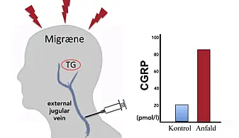 Når du tar en blodprøve fra blodet som har vært gjennom sirkulasjonen i hodet, kan du undersøke signalstoffene som har blitt utskilt. Betydningen av CGRP i migrene ble illustrert på denne måten, ved at CGRP var forhøyet under et migreneanfall. TG står for «Trigeminal Ganglion», en samling av sensoriske nerver som kontrollere blodårene i hinnen som ligger rundt om hjernen. (Illustrasjon: Edvinsson, Haanes, Warfvinge og Krause) Når du tar en blodprøve fra blodet som har vært gjennom sirkulasjonen i hodet, kan du undersøke signalstoffene som har blitt utskilt. Betydningen av CGRP i migrene ble illustrert på denne måten, ved at CGRP var forhøyet under et migreneanfall. TG står for «Trigeminal Ganglion», en samling av sensoriske nerver som kontrollere blodårene i hinnen som ligger rundt om hjernen. (Illustrasjon: Edvinsson, Haanes, Warfvinge og Krause)