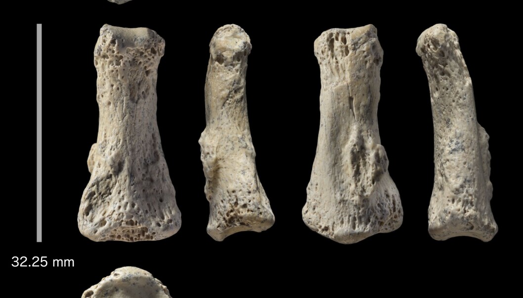 Fingerknokkelen fra forskjellige sider. Det er et av fingerleddene som er funnet. (Foto: Ian Cartwright) Fingerknokkelen fra forskjellige sider. Det er et av fingerleddene som er funnet. (Foto: Ian Cartwright)