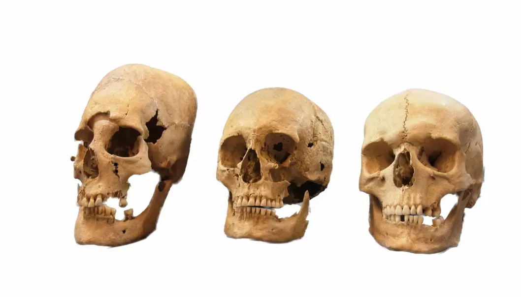 Dette bildet viser en sterkt deformert hodeskalle (til venstre), en middels deformert hodeskalle (i midten) og en normal hodeskalle (til høyre). Genmaterialet fra de langpannede hodeskallene ser ut til å bevise kvinnelig migrasjon over store distanser på et tidspunkt hvor man har tenkt at dette først og fremst var forbeholdt menn. (Foto: State Collection for Anthropology and Palaeoanatomy Munich)