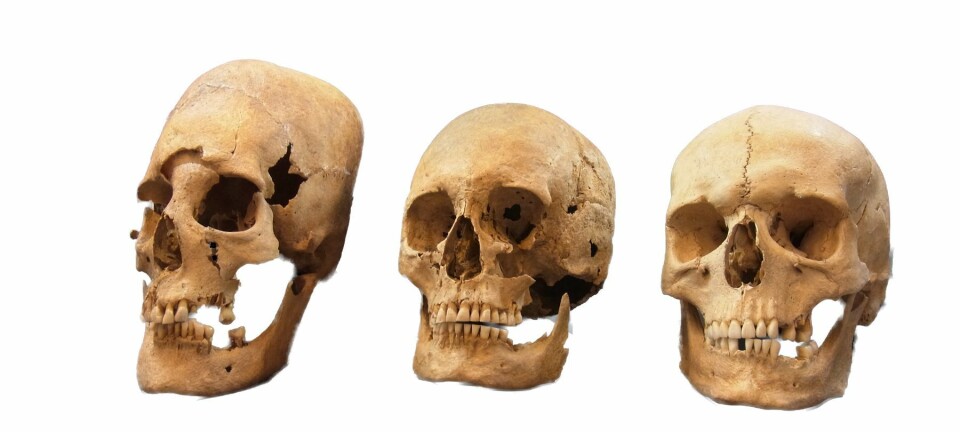 Dette bildet viser en sterkt deformert hodeskalle (til venstre), en middels deformert hodeskalle (i midten) og en normal hodeskalle (til høyre). Genmaterialet fra de langpannede hodeskallene ser ut til å bevise kvinnelig migrasjon over store distanser på et tidspunkt hvor man har tenkt at dette først og fremst var forbeholdt menn. (Foto: State Collection for Anthropology and Palaeoanatomy Munich)