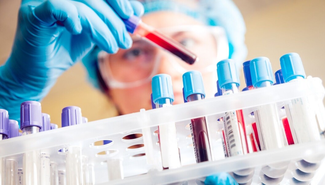 Mer nyansert diabetesdefinisjon kan gi bedre behandlingsmetoder. (Illustrasjonsfoto: Romaset, Shutterstock, NTB scanpix) Mer nyansert diabetesdefinisjon kan gi bedre behandlingsmetoder. (Illustrasjonsfoto: Romaset, Shutterstock, NTB scanpix)