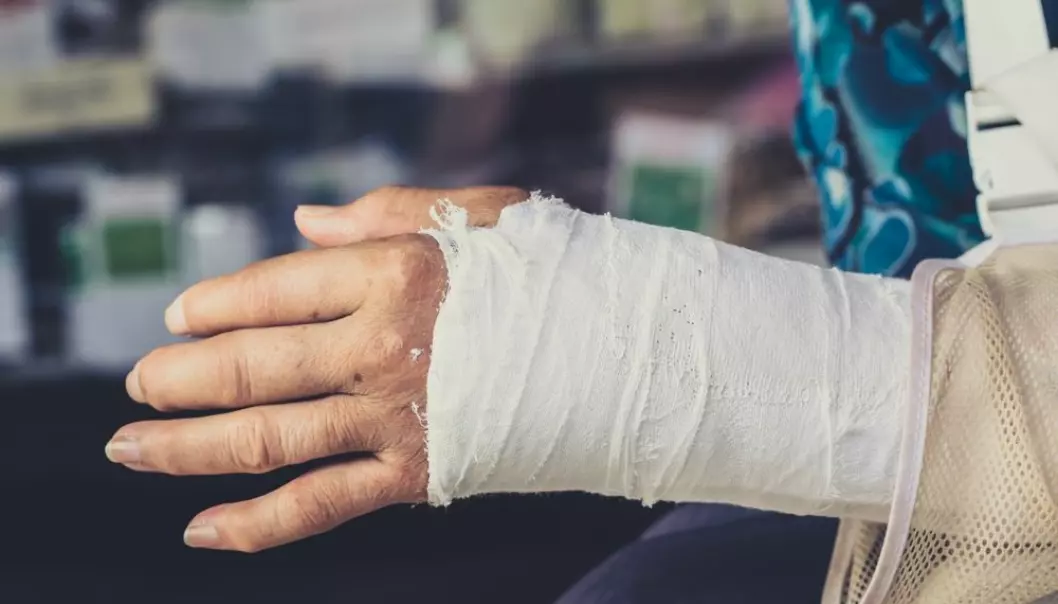 Håndleddsbrudd hos godt voksne og eldre er ofte et resultat av beinskjørhet. En studie ved Universitetet i Bergen viste at 64 prosent av kvinnelige og 49 prosent av mannlige pasienter med håndleddsbrudd hadde behandlingstrengende osteoporose. (Foto: Colourbox)