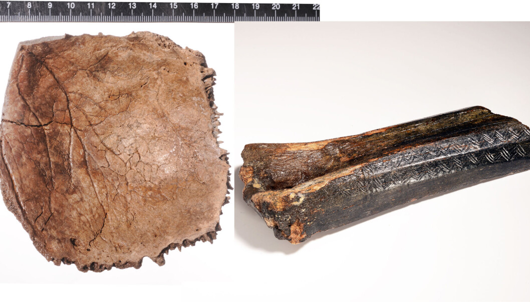 De to knoklene har blitt dratt opp fra bunnen av Nordsjøen. (Bilde: Kollasj/Rijksmuseum van Oudheden) De to knoklene har blitt dratt opp fra bunnen av Nordsjøen. (Bilde: Kollasj/Rijksmuseum van Oudheden)