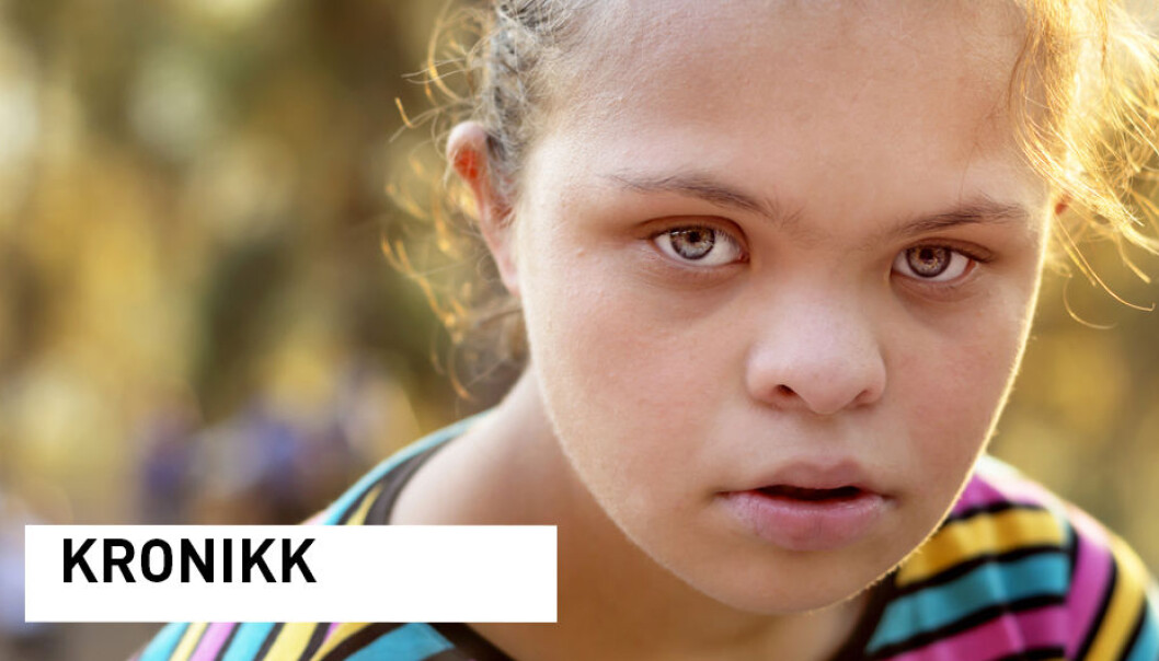 - Personer med Downs Syndrom er disponert for en rekke sykdommer som hjertesykdom, sykdom i mage og tarmkanalen og demens. Å leve med flere sykdommer kan bety å leve med flere smertefulle tilstander. Det igjen betyr behov for oftere og mer systematiske helsekontroller med flere nødvendige, men smertefulle utredninger. I tillegg opplever flere smerter i forbindelse med daglige aktiviteter, forklarer kronikkforfatterne. (Foto: Shutterstock / NTB scanpix) - Personer med Downs Syndrom er disponert for en rekke sykdommer som hjertesykdom, sykdom i mage og tarmkanalen og demens. Å leve med flere sykdommer kan bety å leve med flere smertefulle tilstander. Det igjen betyr behov for oftere og mer systematiske helsekontroller med flere nødvendige, men smertefulle utredninger. I tillegg opplever flere smerter i forbindelse med daglige aktiviteter, forklarer kronikkforfatterne. (Foto: Shutterstock / NTB scanpix)