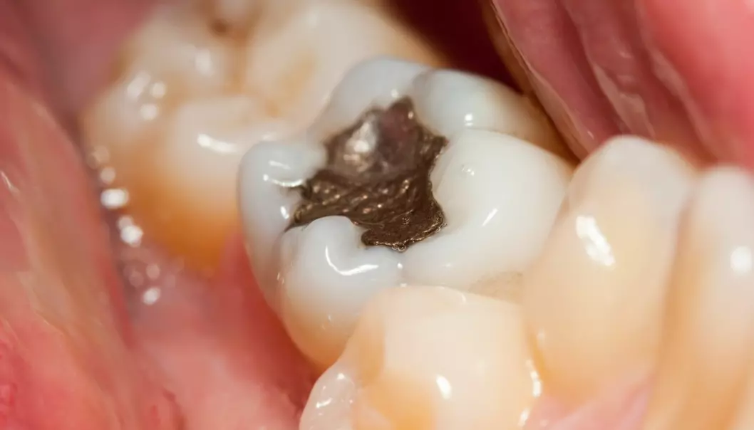 Er det farlig med mye amalgam i tennene?