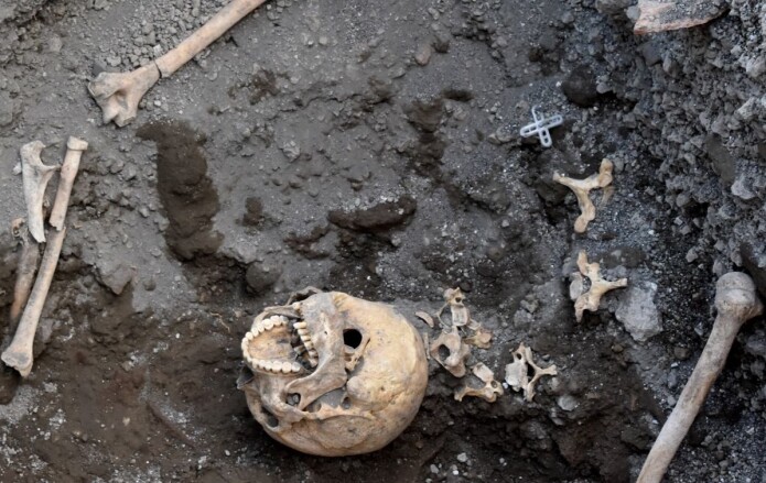 Skallen var ikke knust av den store steinen. (Foto: Pompeii – Parco Archeologico) Skallen var ikke knust av den store steinen. (Foto: Pompeii – Parco Archeologico)