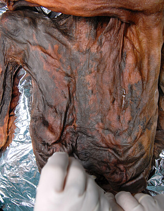 Magesekken til Ötzi er godt bevart. (Foto: Southtyrolarchaeologymuseum\ Eurac\M.Samadelli) Magesekken til Ötzi er godt bevart. (Foto: Southtyrolarchaeologymuseum\ Eurac\M.Samadelli)