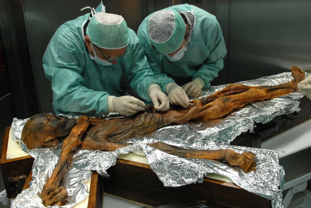 Hva spiste Ötzi? Forskere leter forsiktig etter matrester i magen til ismannen. (Foto: Southtyrolarchaeologymuseum\Eurac\M.Samadelli) Hva spiste Ötzi? Forskere leter forsiktig etter matrester i magen til ismannen. (Foto: Southtyrolarchaeologymuseum\Eurac\M.Samadelli)