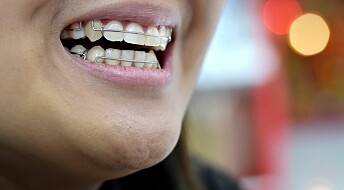 Hormon kan hjelpe mot løse tenner etter regulering