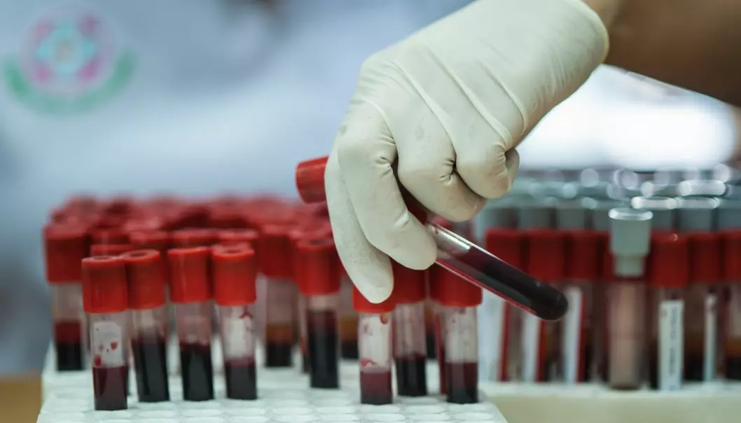 Forskere tester ut blodprøve som kan avdekke åtte kreftformer