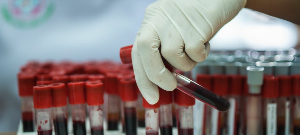 Forskere melder om framgang i arbeidet med å utvikle en blodprøvetest som kan avdekke kreft. (Illustrasjonsfoto: somsak suwanput, Shutterstock, NTB scanpix)