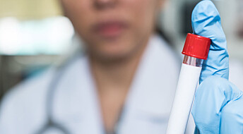 Forsker vil ha flere i behandling for hepatitt C