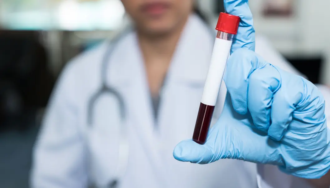 Mellom 11 000 og 17 000 personer lever med hepatitt C i Norge i dag. (Illustrasjonsfoto: Shutterstock / NTB Scanpix) Mellom 11 000 og 17 000 personer lever med hepatitt C i Norge i dag. (Illustrasjonsfoto: Shutterstock / NTB Scanpix)