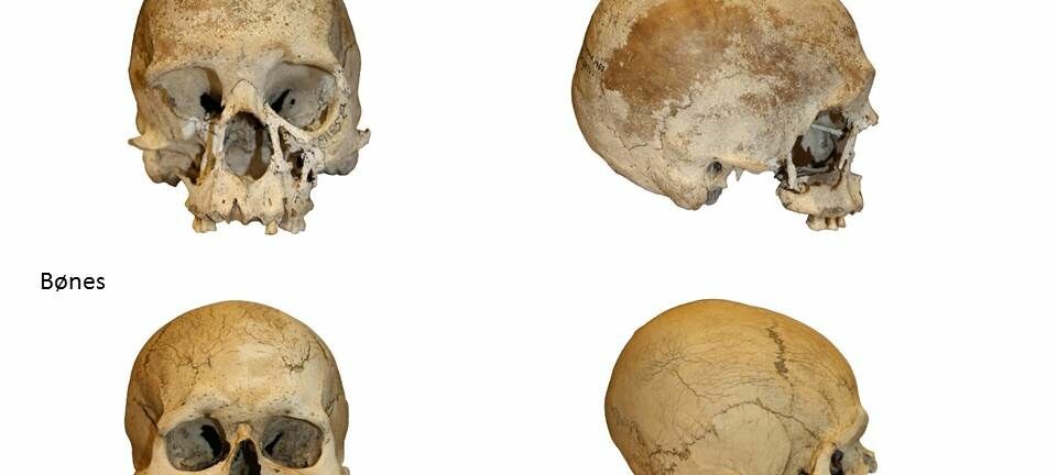 De to hodeskallene funnet i 1952 og 2015 er begge rundt 8500 år gamle. De er fra samme område, muligens samme folkeslag. Men de ser helt forskjellige ut. (Foto: Anne Karin Hufthammer)