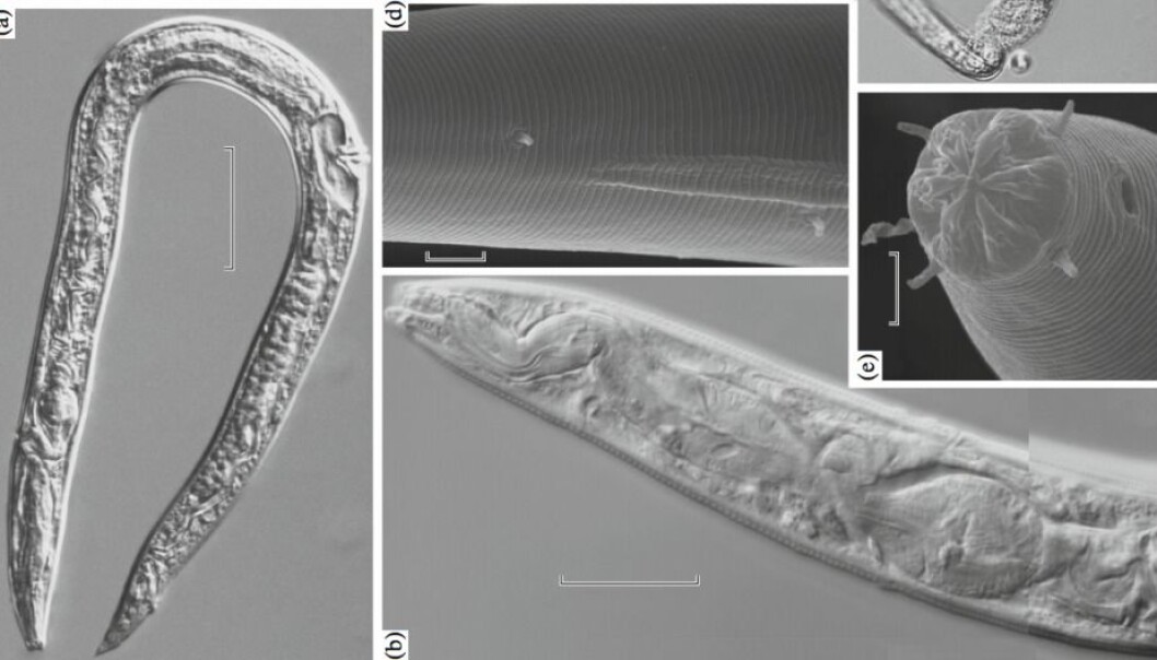 Rundormene ble isolert fra avleiringer fra forrige istiden i det nordøstlige Russland (Sibir). Her ses ulike utsnitt av dyret. (Foto: Shatilovich et al., Doklady Biological Sciences) Rundormene ble isolert fra avleiringer fra forrige istiden i det nordøstlige Russland (Sibir). Her ses ulike utsnitt av dyret. (Foto: Shatilovich et al., Doklady Biological Sciences)
