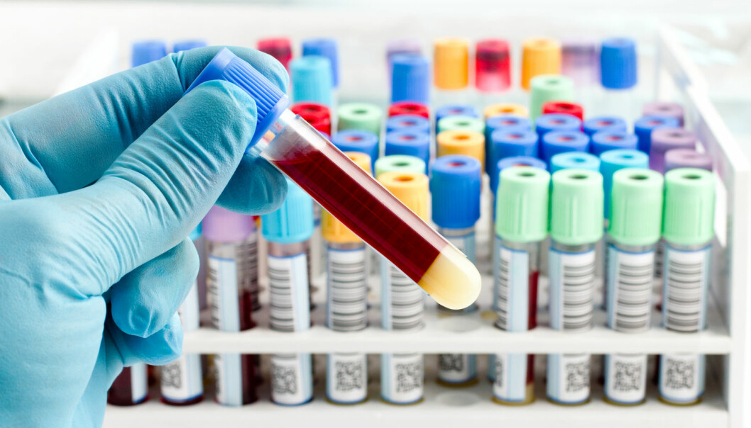 Blodprøver avslører mulig årsak til kobling mellom antibiotika og død
