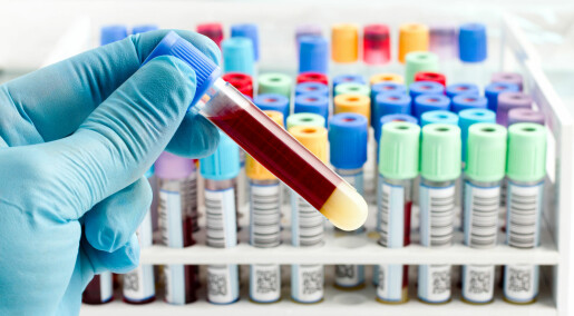 Blodprøver avslører mulig årsak til kobling mellom antibiotika og død