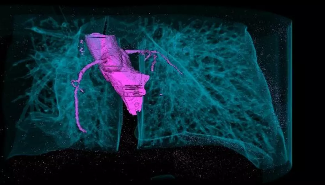 Slik ser det ut på innsiden av et menneskekropp. De blå linjene er lungene, mens det rosa er hovedpulsåren som går ned til hjertet. Ved hjelp av slike bilder kan forskerne på sikt redde liv. (Foto: Ingunn Westvik Jolma / IRIS)