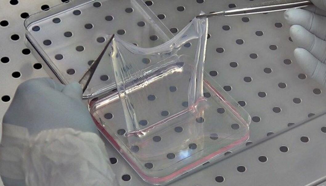 Tyske forskere har lyktes med å transplantere genmanipulert hud på store deler av kroppen til en syv år gammel gutt med en alvorlig hudsykdom. (Foto: CMR Unimore) Tyske forskere har lyktes med å transplantere genmanipulert hud på store deler av kroppen til en syv år gammel gutt med en alvorlig hudsykdom. (Foto: CMR Unimore)