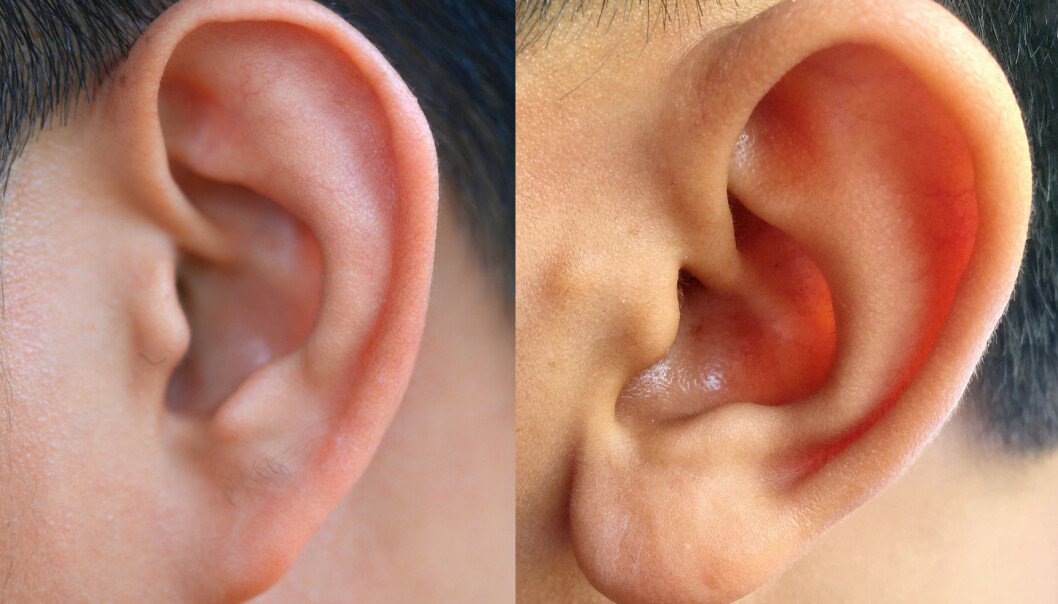 Noen øreflipper er fastgrodde mens andre dingler fritt. Men det er ikke ett gen som bestemmer hva slags flipp du har fått, ifølge en ny studie. (Foto: Thanakorn Hongphan / Shutterstock / NTB scanpix og Thiti Sukapan / Shutterstock / NTB scanpix) Noen øreflipper er fastgrodde mens andre dingler fritt. Men det er ikke ett gen som bestemmer hva slags flipp du har fått, ifølge en ny studie. (Foto: Thanakorn Hongphan / Shutterstock / NTB scanpix og Thiti Sukapan / Shutterstock / NTB scanpix)