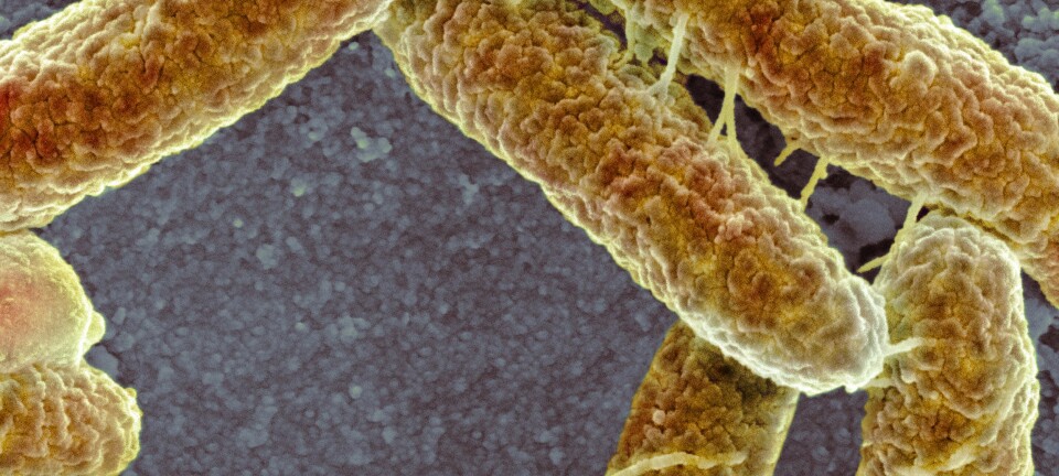 Disse bakteriene utveksler gener. Du kan se at de er koblet sammen med små tråder, noe gjør det mulig for bakteriene å dele på egenskaper. Antibiotikaresistens kan gis videre på denne måten.  (Foto: Science Photo Library / Scanpix)