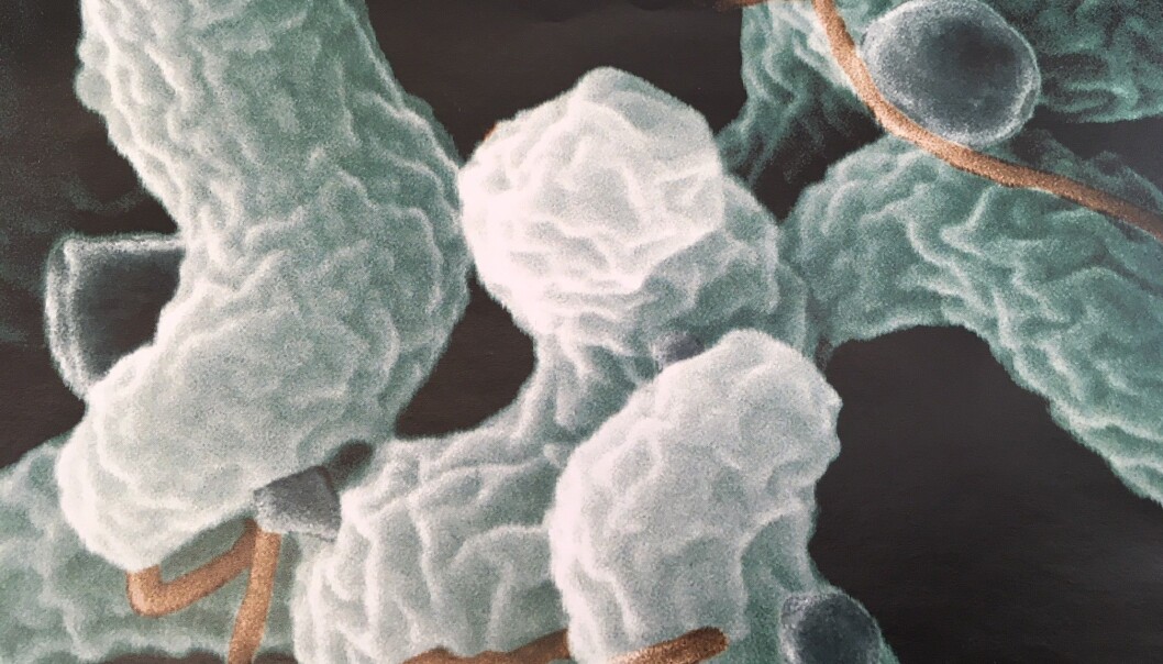 Minst to tusen nordmenn ble registrert smittet av campylobacter som gir diaré i fjor. Omlag 500 av disse fikk smitten gjennom norskprodusert kylling. For å begrense tilfellene, testes alle kyllingflokker som skal slaktes. (Foto: Anne Lise Stranden/forskning.no) Minst to tusen nordmenn ble registrert smittet av campylobacter som gir diaré i fjor. Omlag 500 av disse fikk smitten gjennom norskprodusert kylling. For å begrense tilfellene, testes alle kyllingflokker som skal slaktes. (Foto: Anne Lise Stranden/forskning.no)