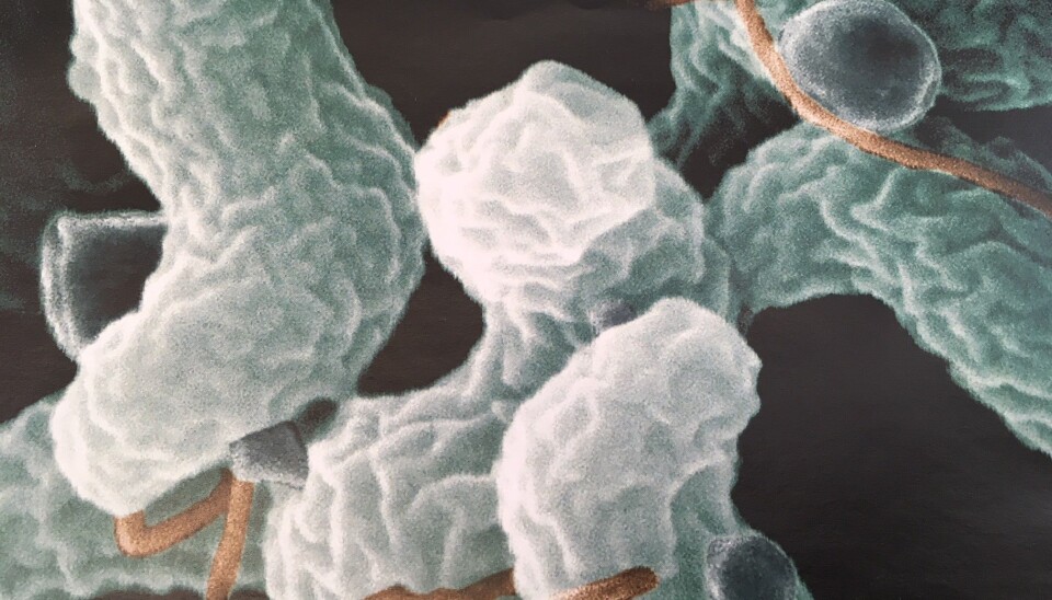 Minst to tusen nordmenn ble registrert smittet av campylobacter som gir diaré i fjor. Omlag 500 av disse fikk smitten gjennom norskprodusert kylling. For å begrense tilfellene, testes alle kyllingflokker som skal slaktes. (Foto: Anne Lise Stranden/forskning.no)