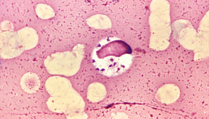 De svarte prikkene er leishmania-parasitter inne i en benmargscelle. (Bilde: CDC) De svarte prikkene er leishmania-parasitter inne i en benmargscelle. (Bilde: CDC)