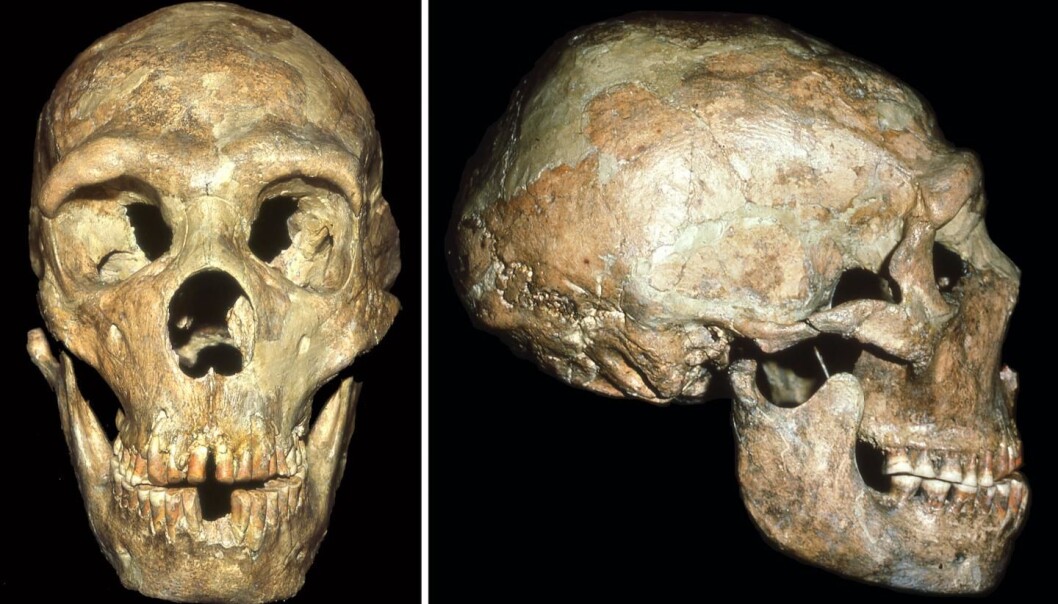 Denne neandertaleren led av mange forskjellige plager. (Foto: Erik Trinkaus) Denne neandertaleren led av mange forskjellige plager. (Foto: Erik Trinkaus)