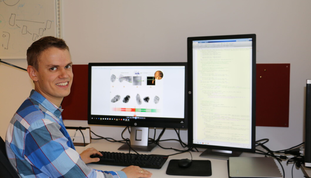 Andreas Kleppe har utviklet et system som kan analysere flere tusen bilder av kreftceller. Tanken er at systemet kan gi mer presise diagnoser. (Foto: Gunhild M. Haugnes/UiO) Andreas Kleppe har utviklet et system som kan analysere flere tusen bilder av kreftceller. Tanken er at systemet kan gi mer presise diagnoser. (Foto: Gunhild M. Haugnes/UiO)