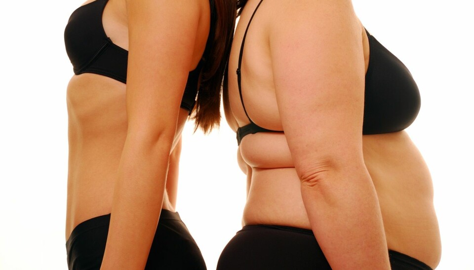 Vi ser i slankeprogrammene hvordan kropper som mister vekt, seksualiseres. Går du ned i vekt, blir belønningen din at du blir mer seksuelt attraktiv, sier Camilla Bruun Eriksen. (Foto: Shutterstock / NTB scanpix)