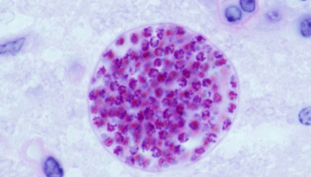 Mikroskopiske cyste full av Toxoplasma gondii-parasitter - her i hjernen til en mus. Der kan få musa til å bli tiltrukket av kattetiss-lukt, noe som blir fatalt for musa. Parasitten oppnår å komme seg i tarmen til et kattedyr, som den trenger for å lage nye slike cyster som havner i avføringen - og kan smitte videre til for eksempel mennesker. (Kilde: Unites States Departement of Agriculture) Mikroskopiske cyste full av Toxoplasma gondii-parasitter - her i hjernen til en mus. Der kan få musa til å bli tiltrukket av kattetiss-lukt, noe som blir fatalt for musa. Parasitten oppnår å komme seg i tarmen til et kattedyr, som den trenger for å lage nye slike cyster som havner i avføringen - og kan smitte videre til for eksempel mennesker. (Kilde: Unites States Departement of Agriculture)