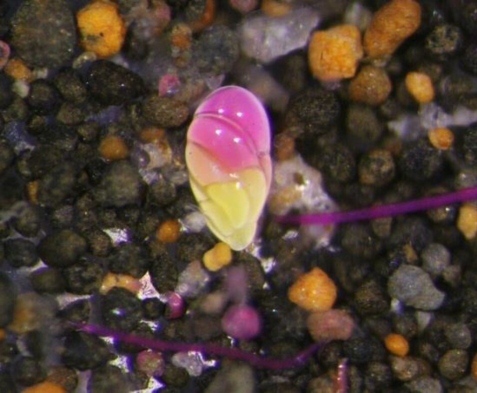 Havbunnslevende foraminifer sett i mikroskopet. (Foto: Marianne Kjøller)