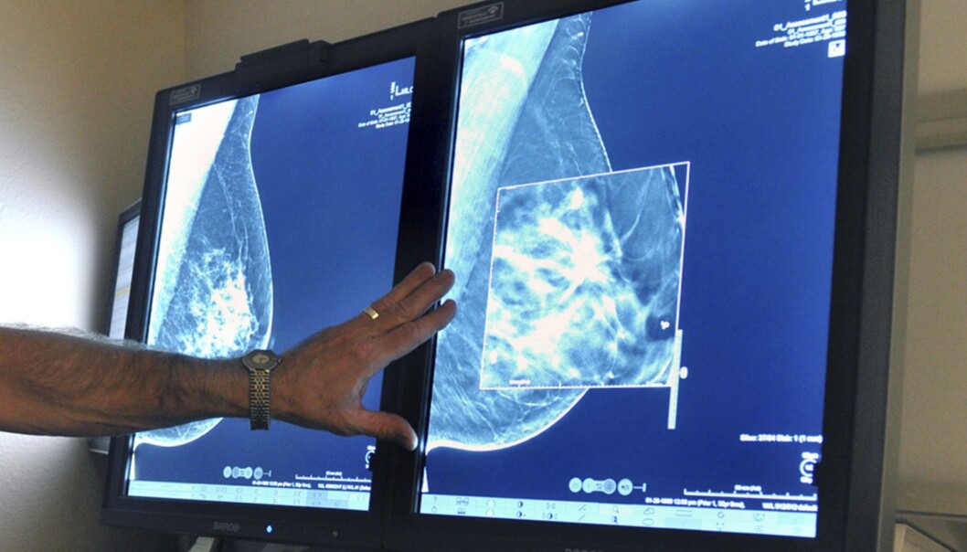Tomosyntese kan vise bryst i tre dimensjoner og oppdage flere kreftsvulster enn dagens mammografi. (Foto:Torin Halsey/Times Record News via AP, NTB Scanpix) Tomosyntese kan vise bryst i tre dimensjoner og oppdage flere kreftsvulster enn dagens mammografi. (Foto:Torin Halsey/Times Record News via AP, NTB Scanpix)