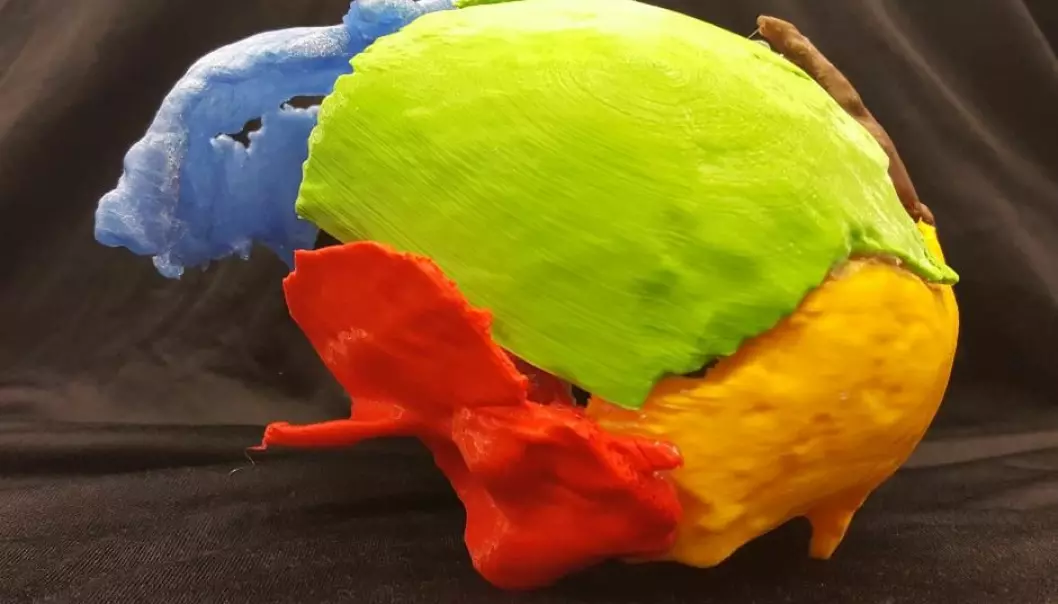 Gorm den Gamle er printet i 3D: Hadde merkelig utvekst i nakken
